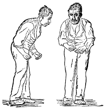 Parkinson's disease - Wikipedia